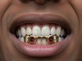 5 Gold Teeth: Front Bridge with Ruby incisors image 0