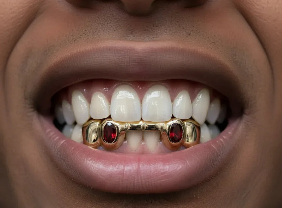 5 Gold Teeth: Front Bridge with Ruby incisors image 0