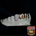 6 Gold Teeth: 2 Diamond and 4 plain image 3