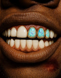 3 Gold Teeth: Triple Opal Set Fronts image 0