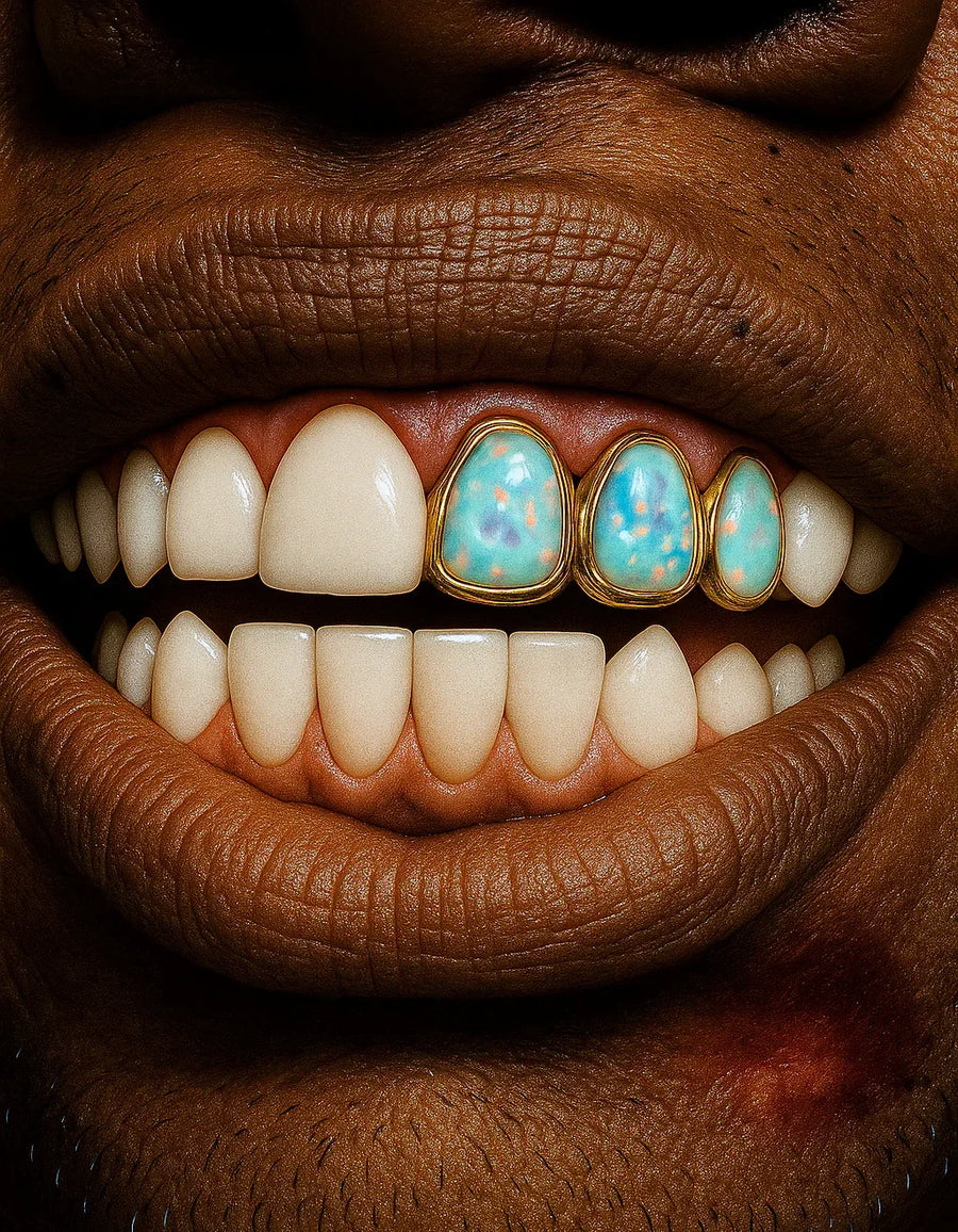 3 Gold Teeth: Triple Opal Set Fronts image 0
