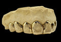 8 Gold Teeth: 10k Yellow Gold 8 Piece With Diamond Dust image 1