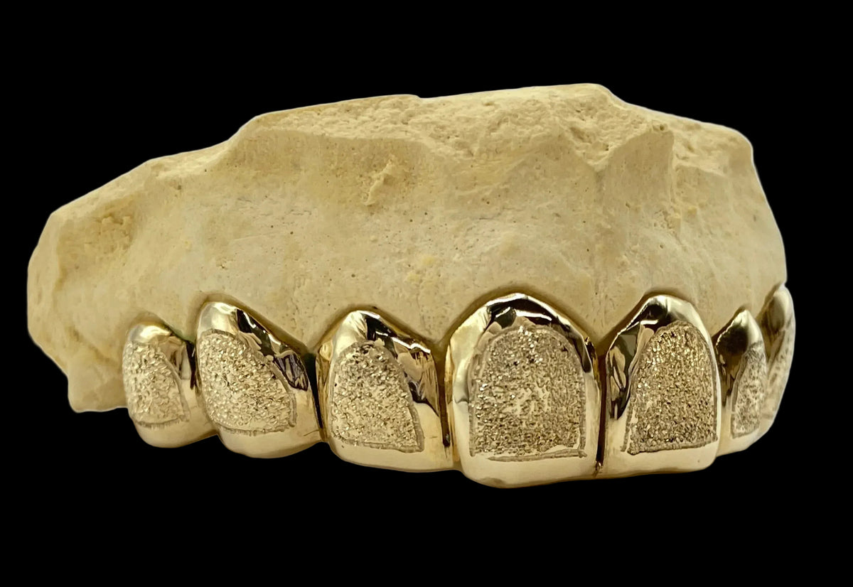 8 Gold Teeth: 10k Yellow Gold 8 Piece With Diamond Dust image 1